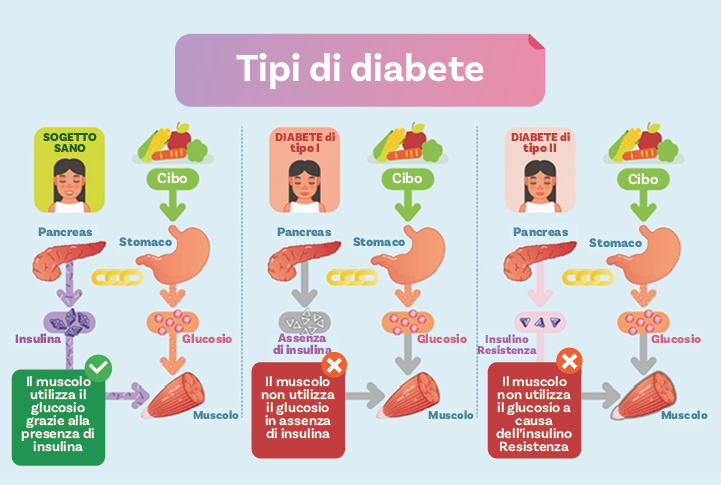 Alimentazione E Diabete - InSalute